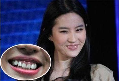 没有耳垂的明星夫妇,独特魅力下的爱情传奇